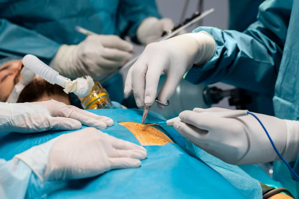 Gallbladder Surgery