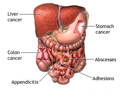 Laparotomy In Pediatric Surgery: Special Considerations And Techniques