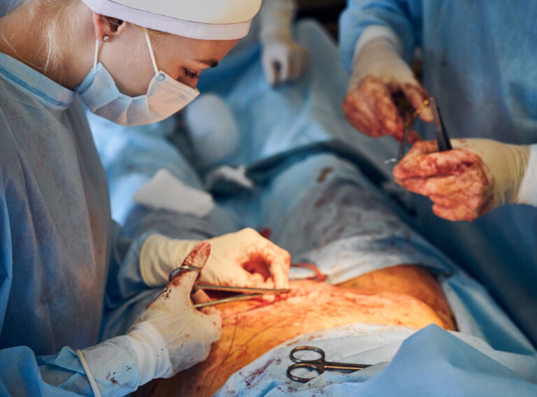 Understanding Fissure Surgery: Procedure, Recovery, and Expectations.