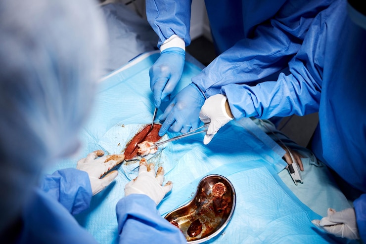 Understanding Hernia Surgery: Types Procedures and Recovery.