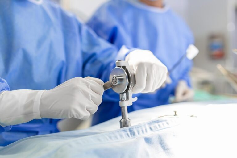 Laparoscopic Surgery in Vikaspuri.