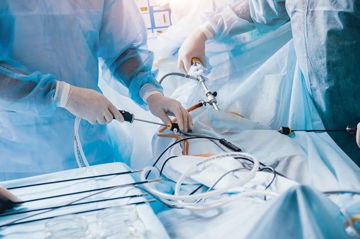 Best Laparoscopic Surgery in Janakpuri