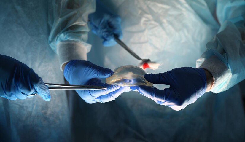 Best Laparoscopic Surgeon in Patel Nagar