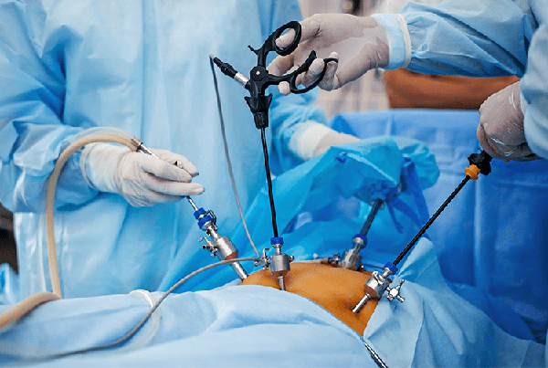 Best Laparoscopic Gastrointestinal Surgery in Patel Nagar