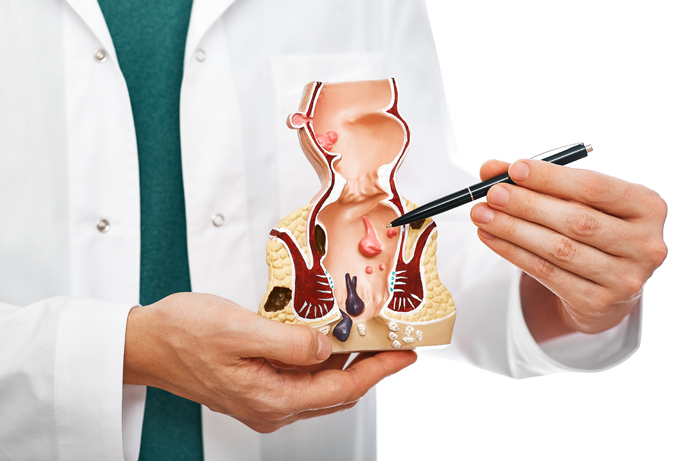 Best Fissure surgery treatment in North Delhi