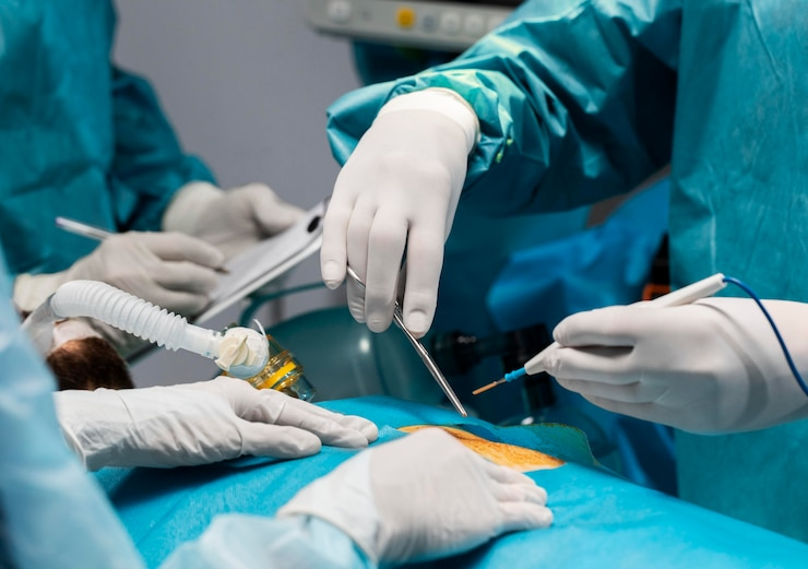 Best Laparoscopic GI Surgery in North Delhi