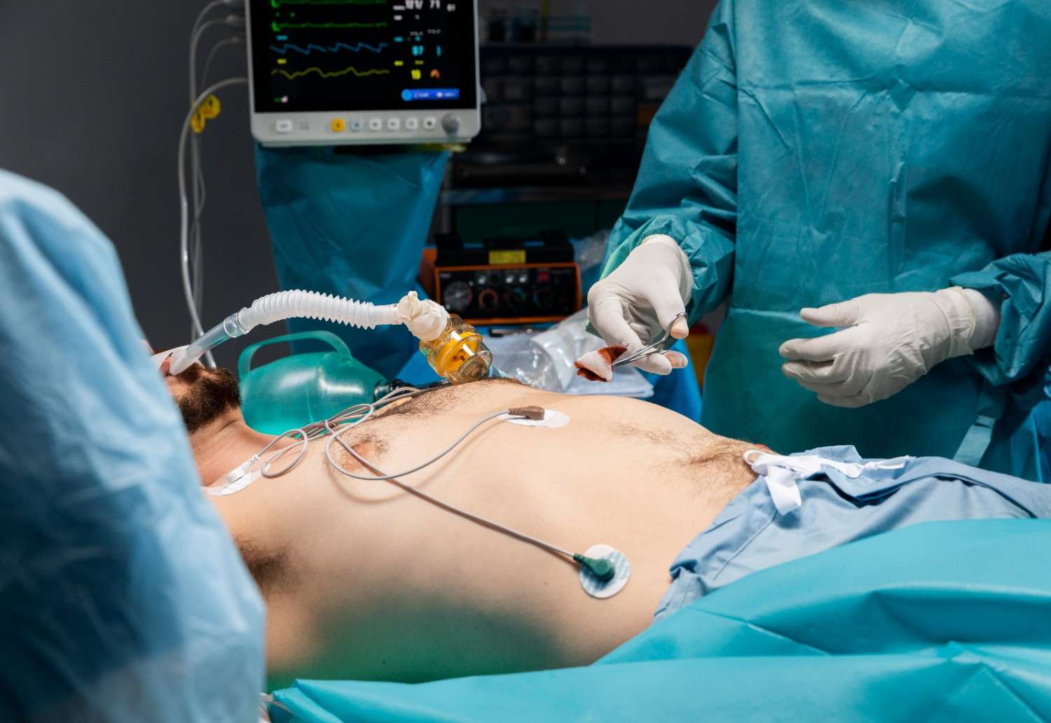 Best Laparotomy Treatment in Rajouri Garden